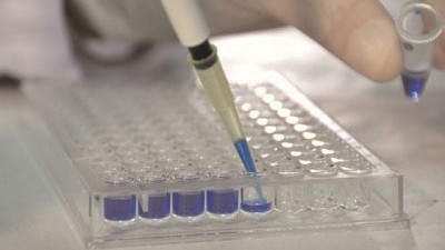 Nanoanticuerpos de llamas: de qué se trata el mejor invento de Latinoamérica