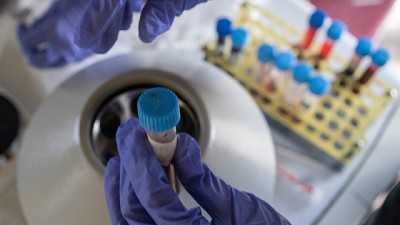 Se agiliza la carga de actas de toma de muestras para diagnósticos de sanidad animal