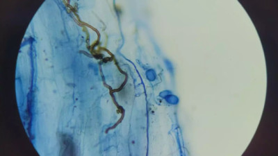 Estudian microorganismos nativos para el control de malezas en pastizales